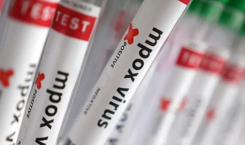 Sobe para 140 número de casos confirmados de Mpox no país, em 2026